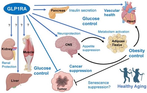 Impact of GLP-1 receptor agonists (GLP-1RAs).